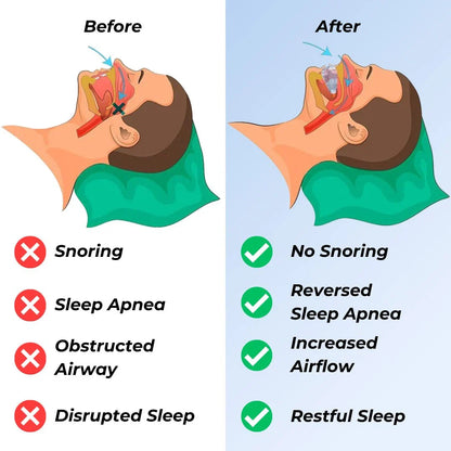 Griqos™ Anti Snoring Mouthpiece - Say goodbye to sleepless nights